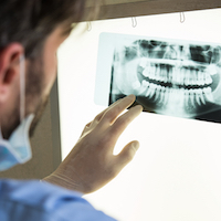 Closeup of dentist looking at dental x-ray plate