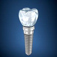 Dental titanium implant , 3D render 