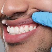 dentist examining mans gums