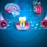 Complications of Gum Disease Image